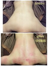 ビューティーアンドボディメイクBB シャオ西尾店/ブライダルエステ☆