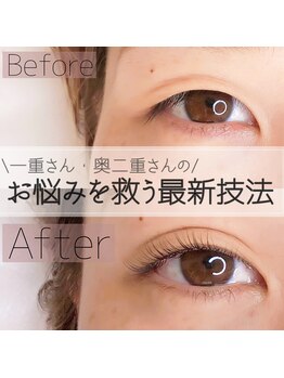 イチマルゴ ガーデン(105 GARDEN)/ダブルアイリフト