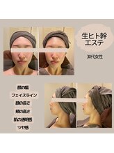 モーイエンチャーム(mooi en charme)/フェイシャル×生ヒト幹50％導入