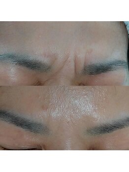 コールドゥ(Coeur-Doux)/☆気になる眉間☆