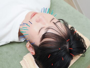 パンダ(Panda)/たるみカット美容鍼