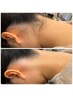 【アップスタイル自信♪】うなじWAX×光脱毛￥ 8,800→￥5,500