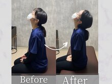 タケダ整体院/急な首の痛みの改善事例