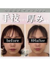 キュープ 松戸店(Qpu)/小顔頭蓋骨矯正