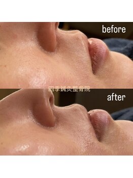 四季鍼灸整骨院/