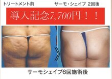エムプリュ 心斎橋店(M.plus)
