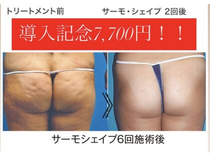エムプリュ(M.plus)の写真