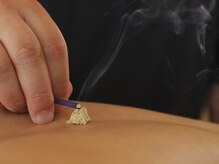 喜絡堂はりきゅうあん摩マッサージ治療院/鍼灸施術【肩こり/腰痛/頭痛】