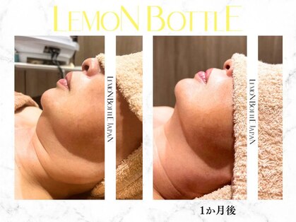 リルチェ 自由が丘(RILUCE)の写真