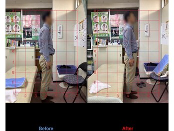 高芝鍼灸整骨院/猫背矯正