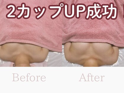 エース(As)の写真