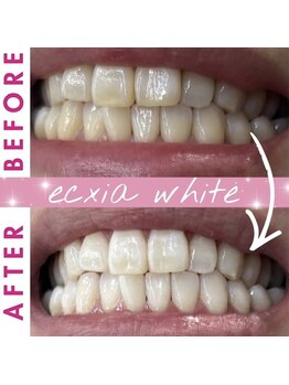 エクシアホワイト 長野店/