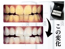 サロン ティアラ(salon tiara)/医療提携ホワイトニング！