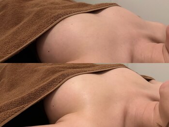 整顔整頭/バストケア