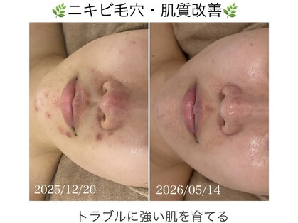 ソフ(soph.)の写真
