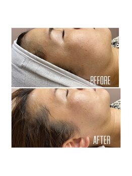 ホワイトワックス 京都四条烏丸(WHITE WAX)/艶肌★