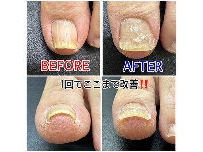 キラキラフット神領 ありが接骨院の写真