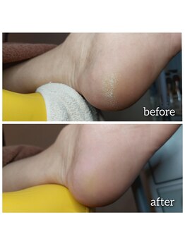 爪切り屋 足楽/