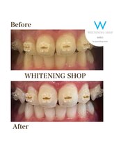 ホワイトニングショップ 緑橋店/メンテナンス中器具もクリーン