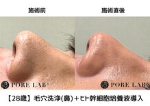 ポア ラボ(Pore Lab)