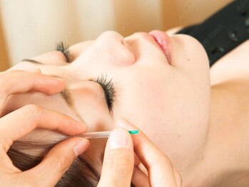 鍼灸院オリーブ(鍼灸院OLIVE)の写真/おすすめは【美容鍼灸】お肌のハリ・ツヤUP!肌の調子を整え自然なリフトアップへと導きます♪