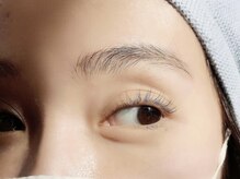 アーピスアイ(APIS eye)