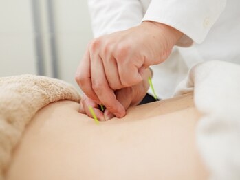 さき鍼灸整骨院