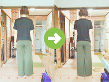 サプライズ整体院/20代ママの初回産後の骨盤矯正