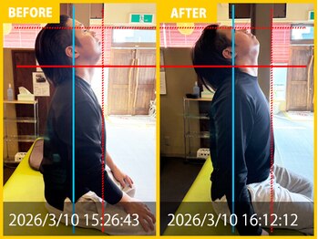 整体院 元 宇城松橋店/首の痛みや肩のハリの悩み