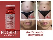 ルミアリュクス(LUMIA LUXE)の雰囲気(レモンボトルの進化版!脂肪分解レッドショット!小顔・たるみ◎)