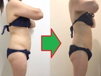 カブール 町田店/インドエステは薄くなります！