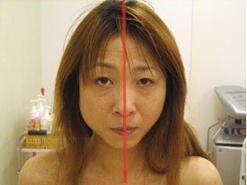 ユウキ(yuuki)/初めてサーモ顔をした私です笑笑