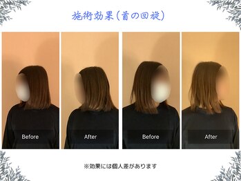 ボディ リセット アンド デザイン(Body Reset & Design)/【施術例】ビフォーアフター