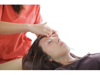 つばさ整骨院 鍼灸院 新潟女池院/（骨盤矯正/整体/腰痛/肩こり)