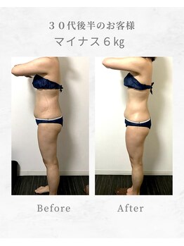 エステサロンクオーツ/30代後半のお客様の変化！