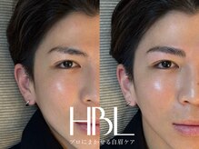 エクラ(Eclat)/HBL／ハリウッドブロウリフト