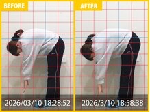 整体院 元 宇城松橋店/20代女性　ひどい腰痛の悩み