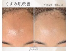 スリースリー 恵比寿(THREE THREE)/くすみ肌・透明感UP ケア