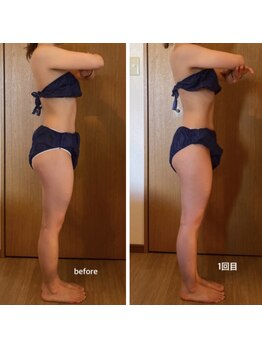 ラナン(Ranan)/BeforeAfter