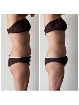 サントーシャ(Santosha)/骨盤矯正効果で見た目もスッキリ