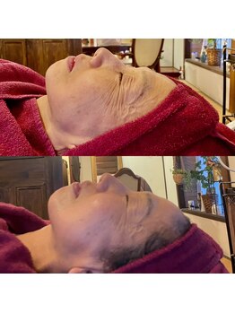 コモア(COMOA)/驚きの効果！喜びの声多数♪♪