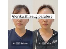 スリージー/before／after