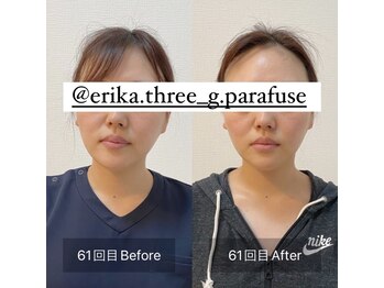 スリージー/before/after