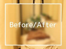 フットケアリストシュウ(footcarelist shu)/施術前後の様子