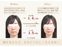 アロハ(ALOHA.)/鏡を見るたびに嬉しくなる未来へ