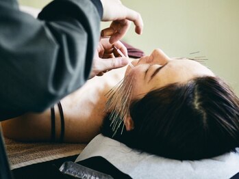 鍼処シラカワ なごや院千種(鍼処SHIRAKAWA)の写真/【鬼美容鍼¥11000★お顔のすっきりから人相＆印象までイメージUPまで♪】その場限りではなく根本の改善へ！