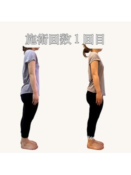 リマ(LIMA)/before→after