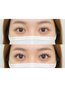 まつげのお悩み解決サロン