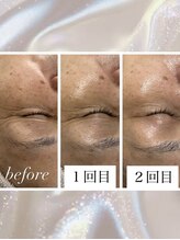 ナナラ(Nanala)/お客様の症例