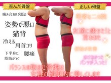 骨盤ちゃん 上越モール店の雰囲気（人体の中心である骨盤が健康であることで心も身体も美しく♪）